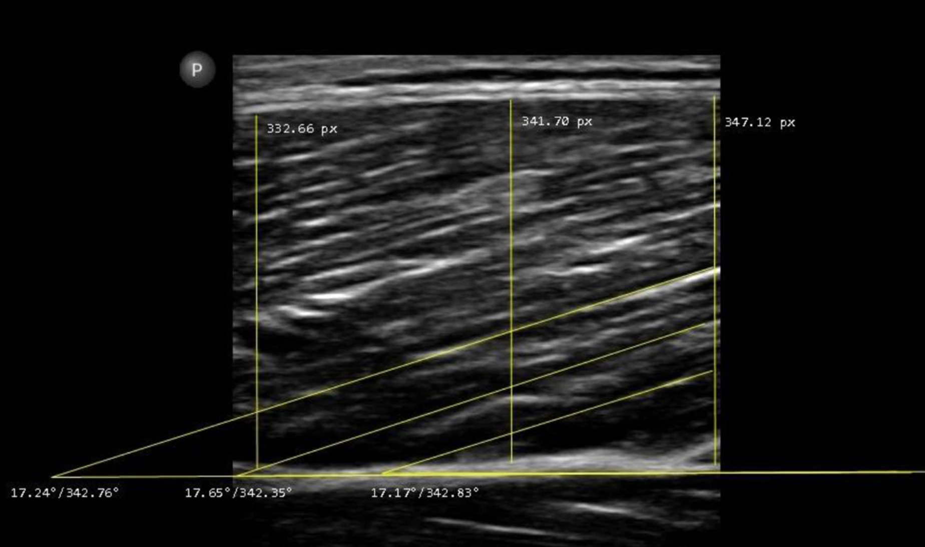 Is Ultrasound Ready To Go Mainstream?