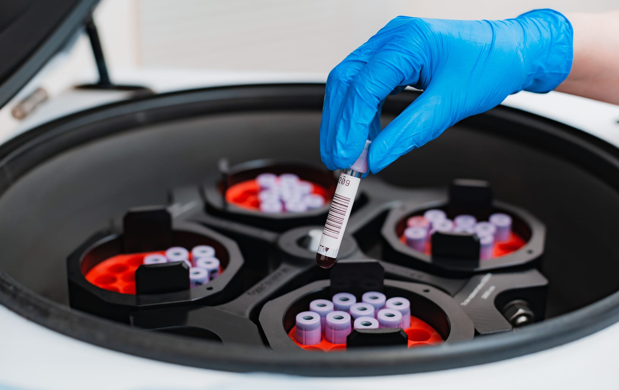 How Does Excess Energy Availability + Passing One's Personal Fat Threshold Influence Blood Biomarkers?
