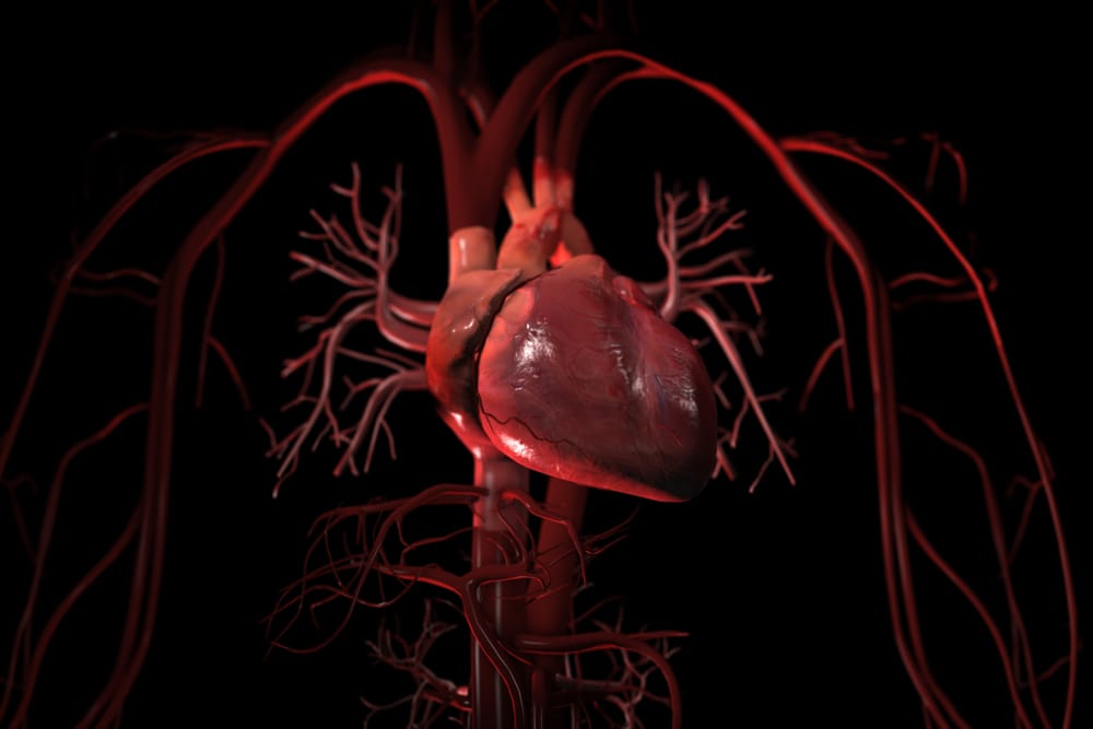 Can Someone Have Wildly High LDL Cholesterol and Zero Plaque?