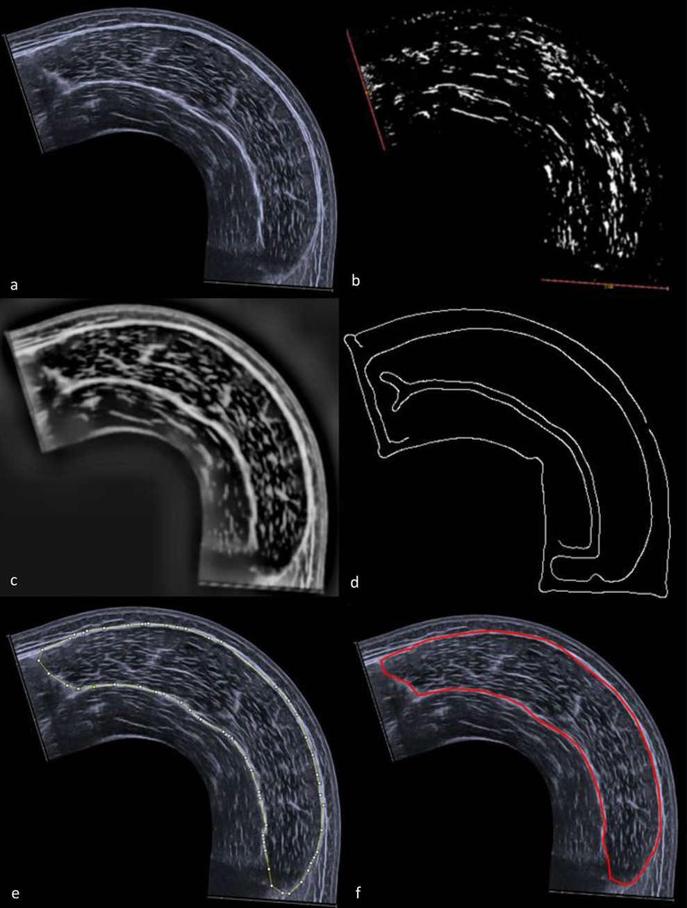 How Much Muscle Cross-Sectional Area Can You Add In A Training Block?